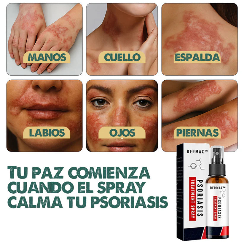 DERMAX™ Spray para Psoriasis – Alivio rápido de picazón, ardor y enrojecimiento